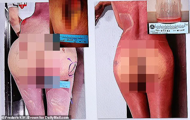 Libby Adame Convicted in Botched Cosmetic Procedure That Killed Former Actress