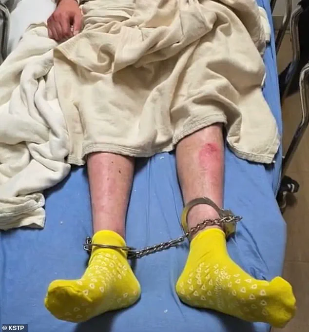 Libyan Immigrant with Rare Genetic Skin Disorder Detained by ICE Amid Immigration Policy Debate