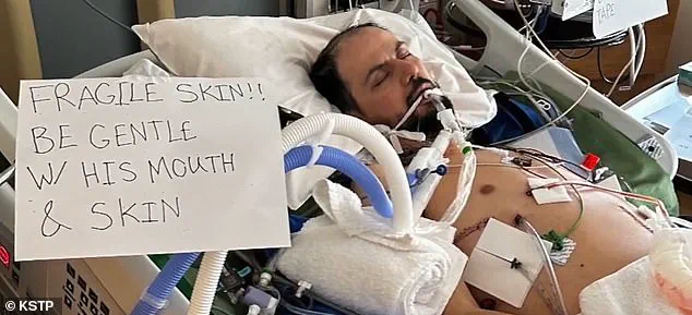 Libyan Immigrant with Rare Genetic Skin Disorder Detained by ICE Amid Immigration Policy Debate