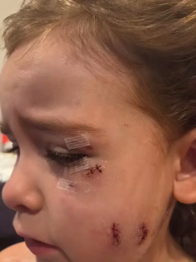 Two Canadian Mothers and Child Injured in Violent Dog Attack by Unleashed American Bulldogs in Oshawa, Ontario