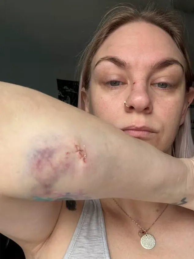 Two Canadian Mothers and Child Injured in Violent Dog Attack by Unleashed American Bulldogs in Oshawa, Ontario