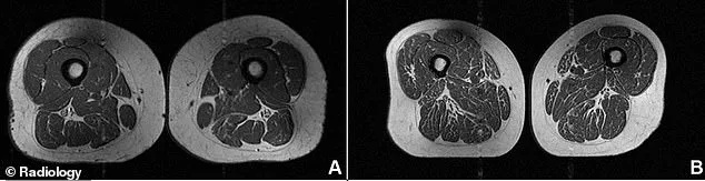 The Dark Side of Ultra-Processed Foods: Unveiling Muscular Damage